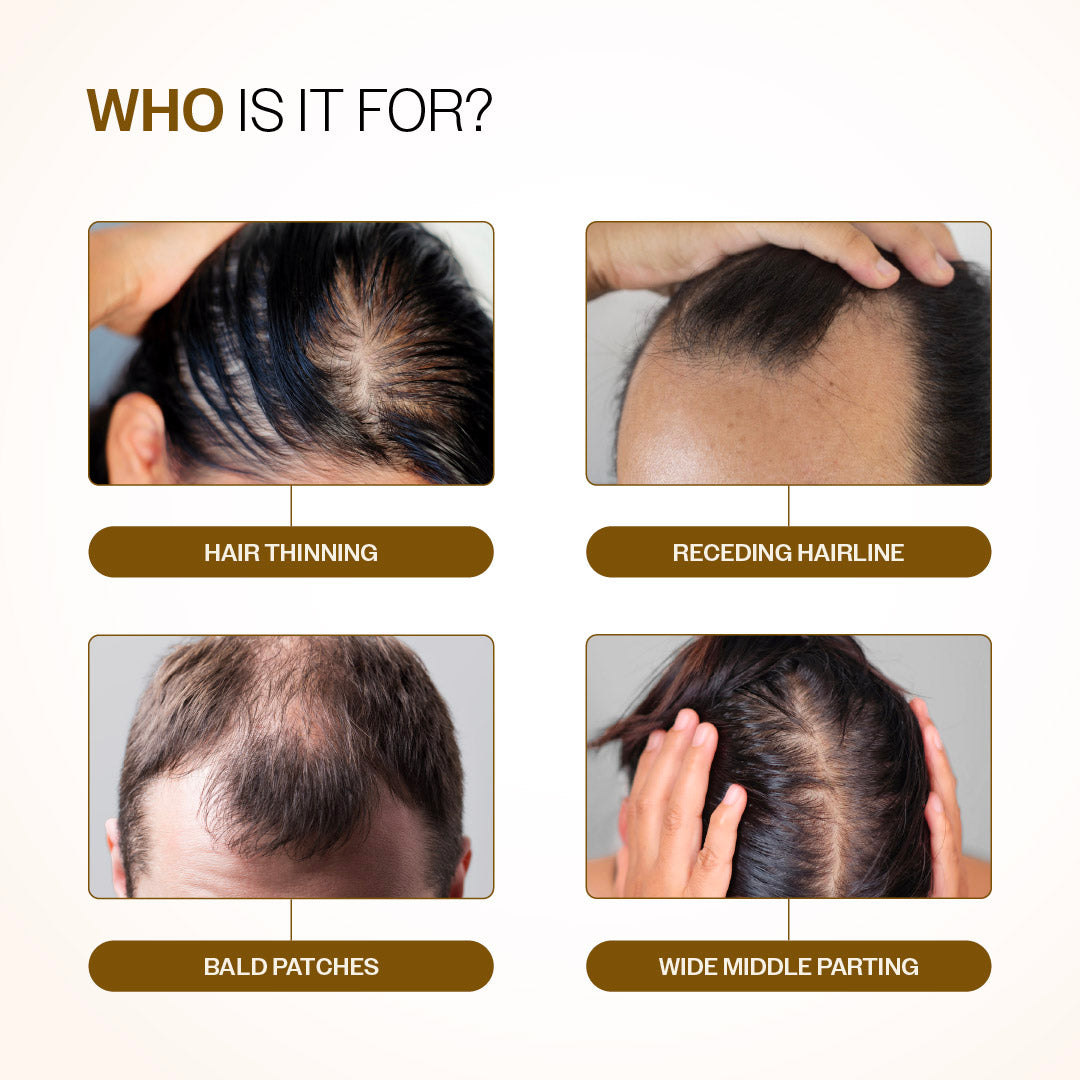 Advanced Hair Growth Serum Roll-On with Redensyl, Rosemary & Rice Water- 25 ml | Pack of 2