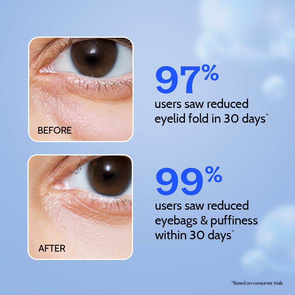 Under Eye Cream with Caffeine & Green Tea - 15 gm | Pack of 3