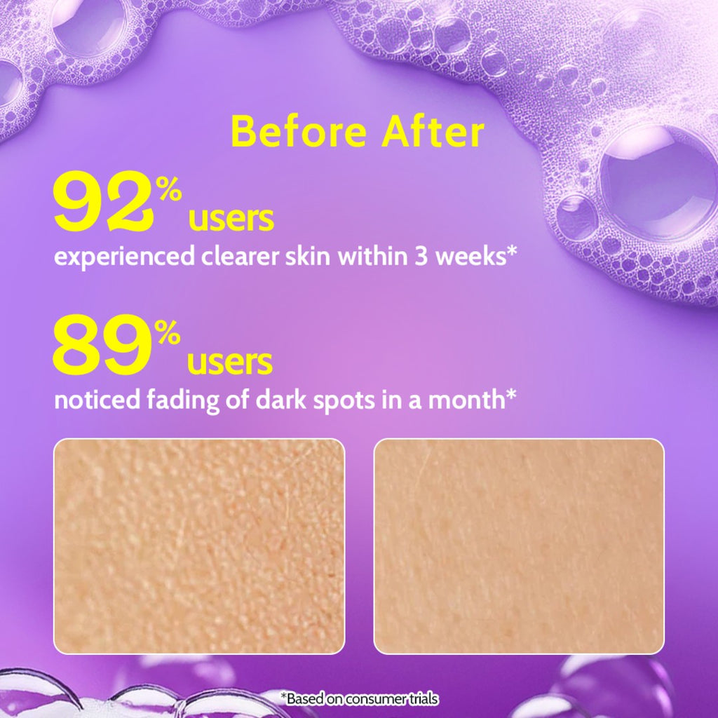 Vitamin C Brightening Boost Face Wash for Dark Spots & Glowing Skin - 100 ml