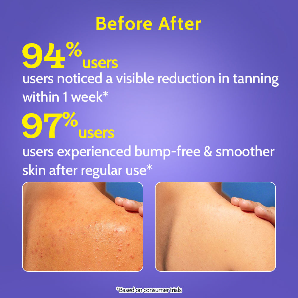 Exfoliating Body Wash with Lactic Acid & Salicylic Acid - 473 ml | Pack of 3