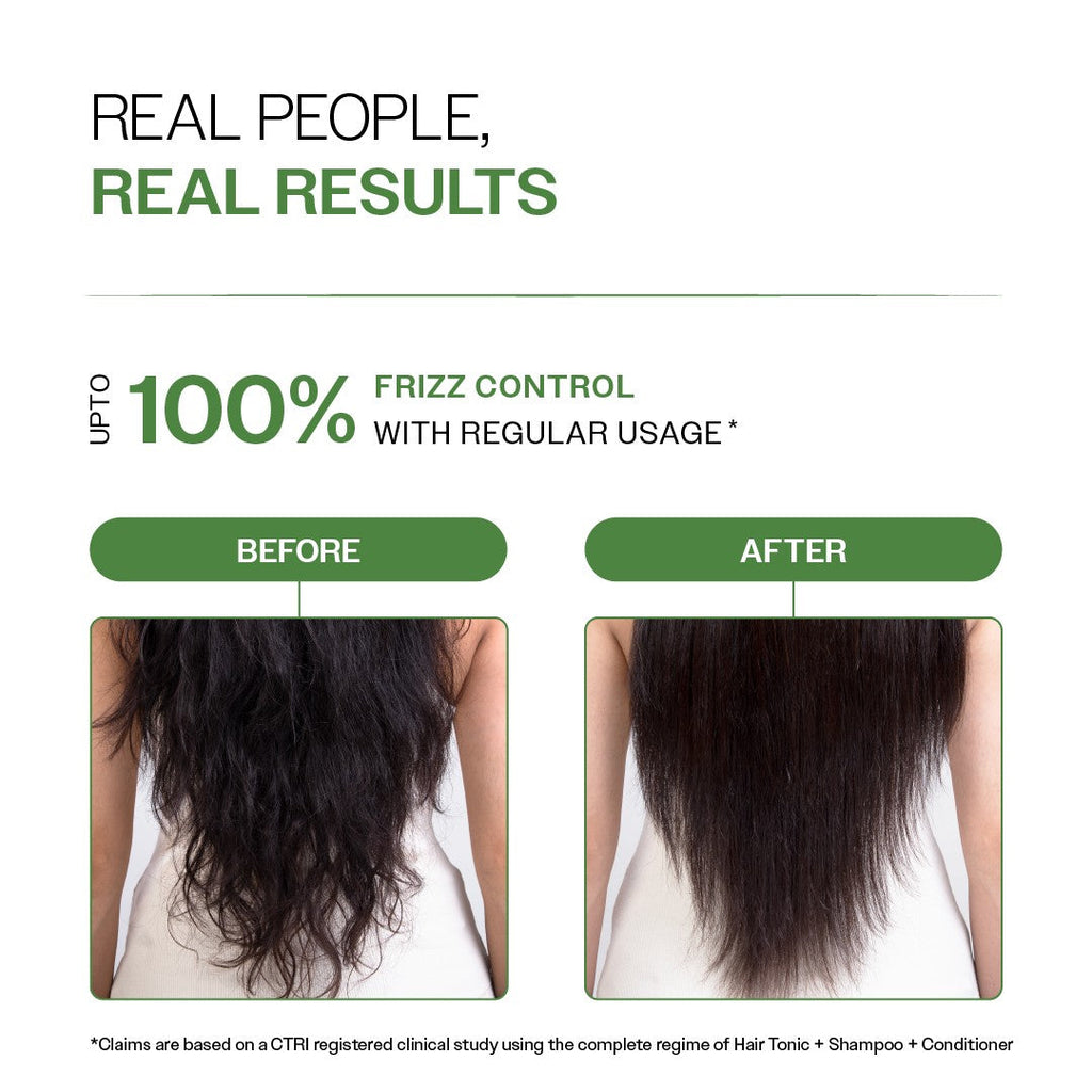Anti-Dandruff Shampoo (250 ml) & Conditioner (175 gm) Combo with Salicylic Acid & Rosemary