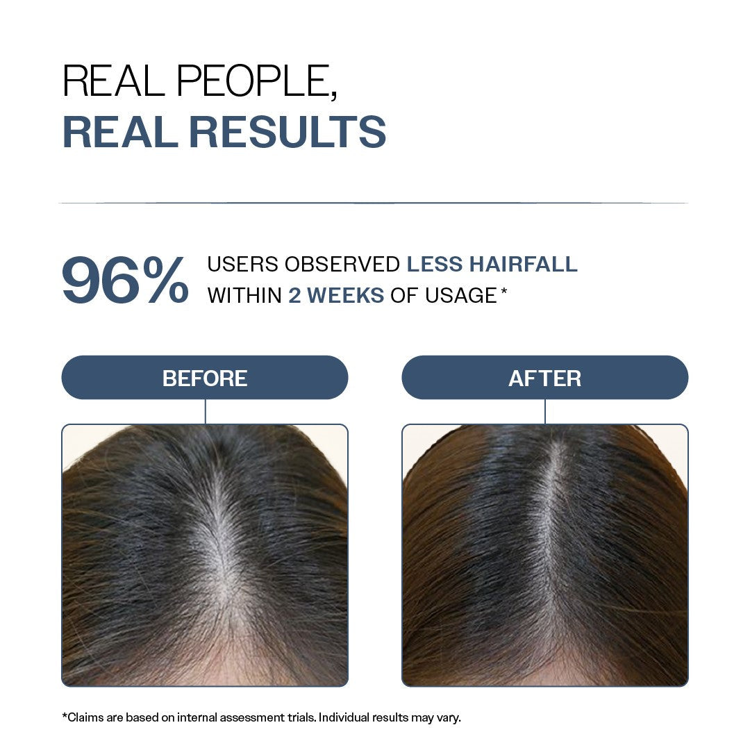 Anti-Hair Fall Shampoo with Adenosine & Peptides - 100 ml | Pack of 3