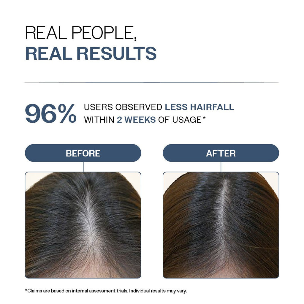 Anti-Hair Fall Shampoo with Adenosine & Peptides - 100 ml | Pack of 2