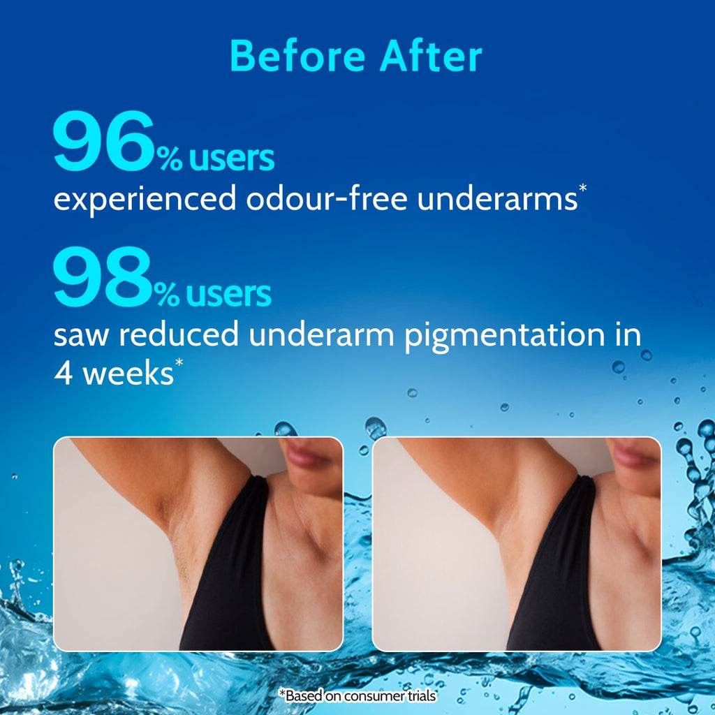 5% AHA Underarm Roll on for Odour Control & Pigmentation (Woody Musk) - 40 ml | Pack of 3