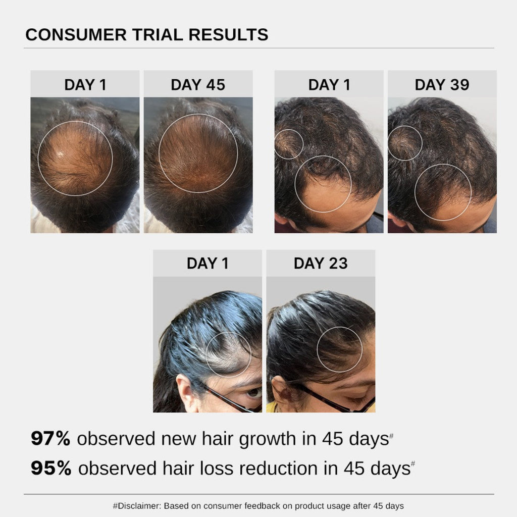 Hair Growth Serum (30 ml | Pack of 3) & Scalp Massager Hair Growth Combo