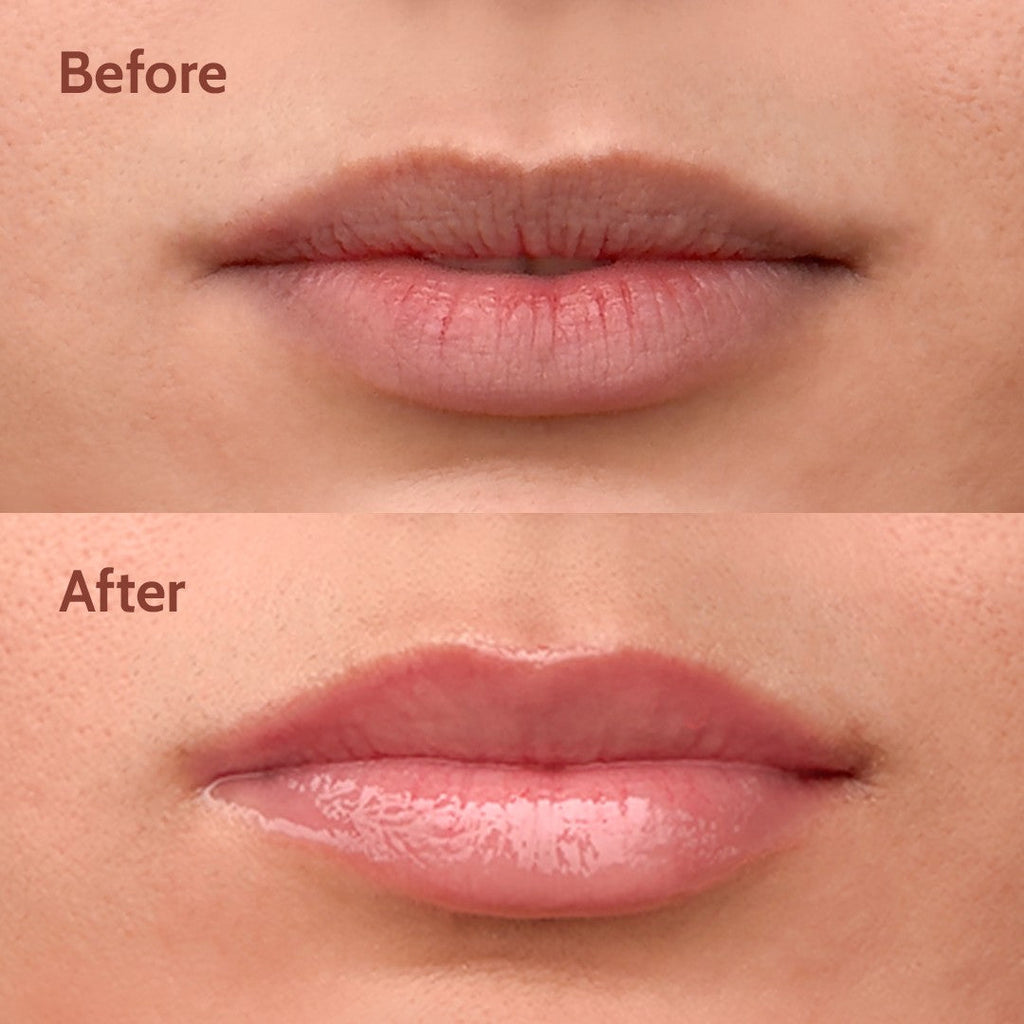 Ceramides + 2% Kojic Acid Lip Balm (Vanilla) | SPF 50 PA++++ | 10 gm