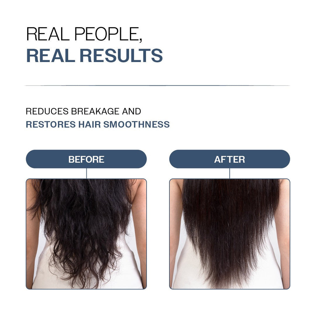 Anti-Hair Fall Shampoo (250 ml) & Conditioner (175 gm) Combo with Redensyl & Rosemary