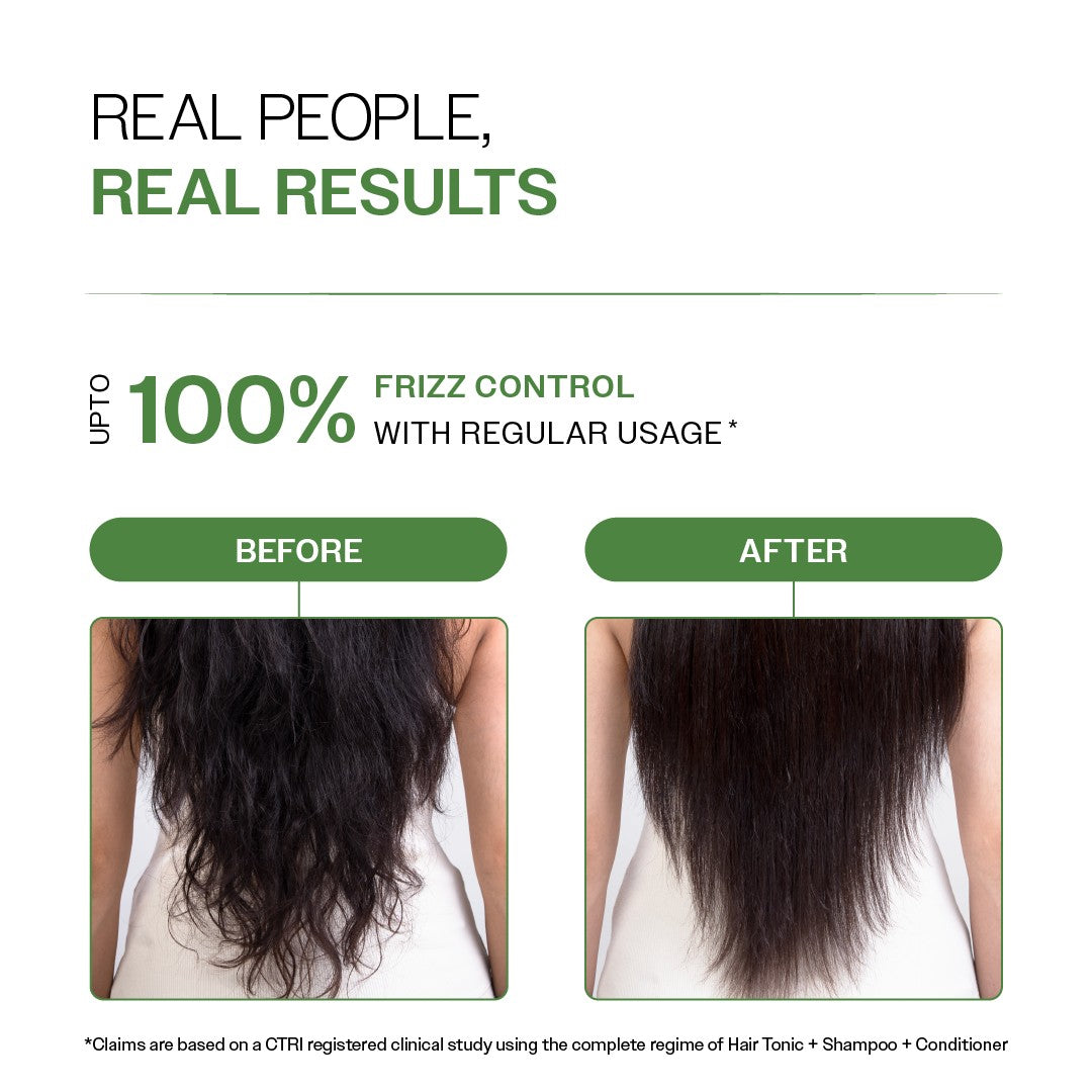 Anti-Dandruff Hair Conditioner with Salicylic Acid, Biotin & Rosemary - 175 gm | Pack of 2
