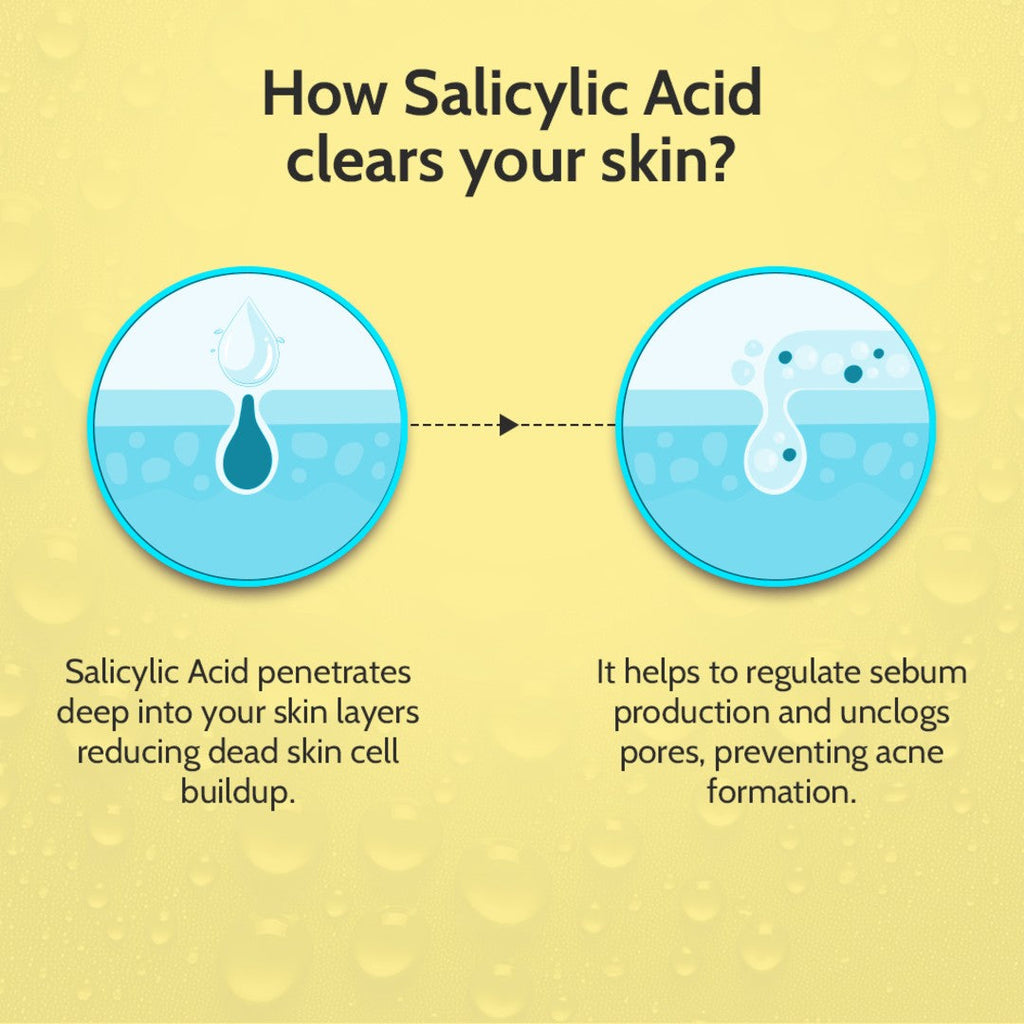 2% Salicylic Acid Face Serum for Acne Control - 30 ml