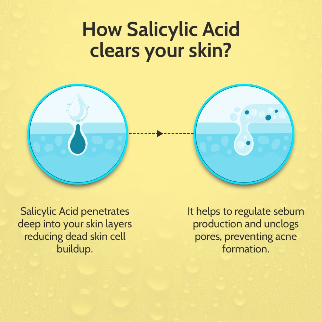 2% Salicylic Acid Face Serum for Acne Control - 30 ml