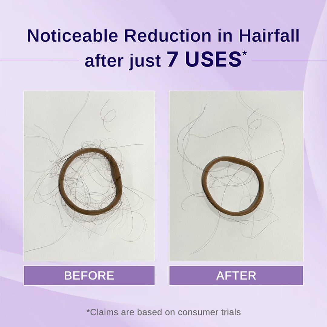 Rosemary & Hibiscus Hair Growth Oil - 100 ml | Pack of 3