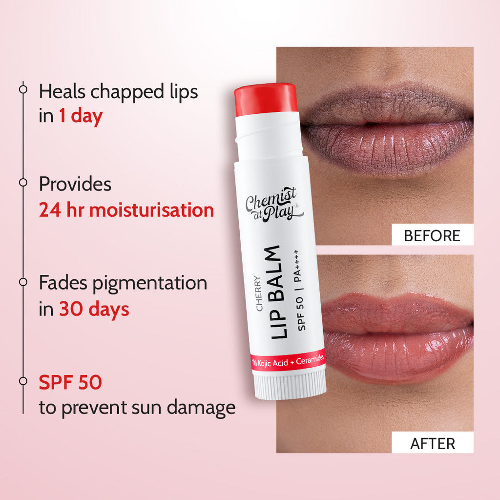 Cherry Lip Balm for Chapped & Pigmented Lips | SPF 50 PA++++ & Kojic Acid | 4.5 gm | Pack of 2