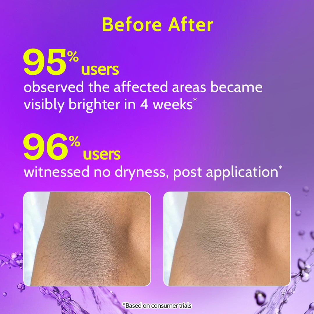 Neck, Knee & Elbow Brightening Roll On - 40 ml | Pack of 3