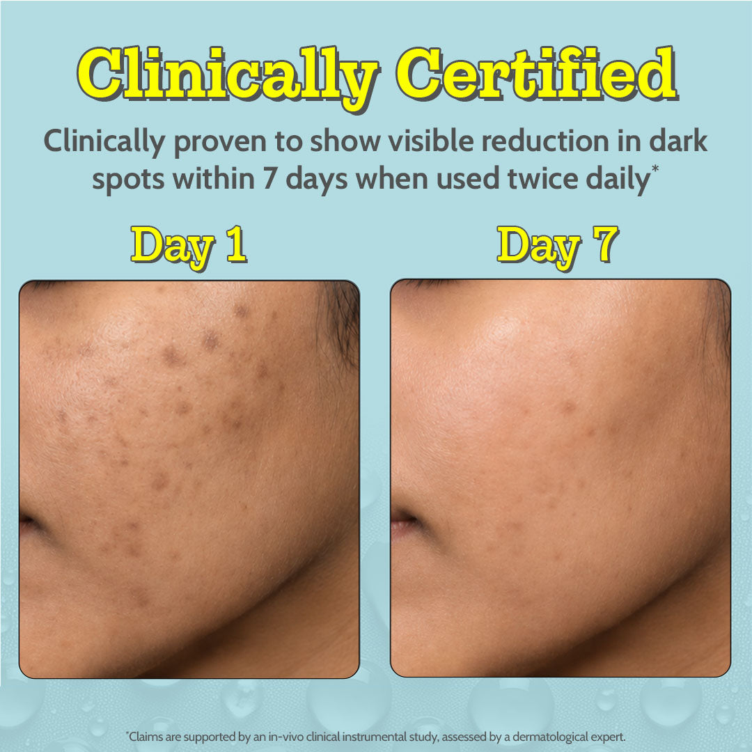 10% Vitamin C Serum for Glowing & Bright Skin - 10 ml | Pack of 2