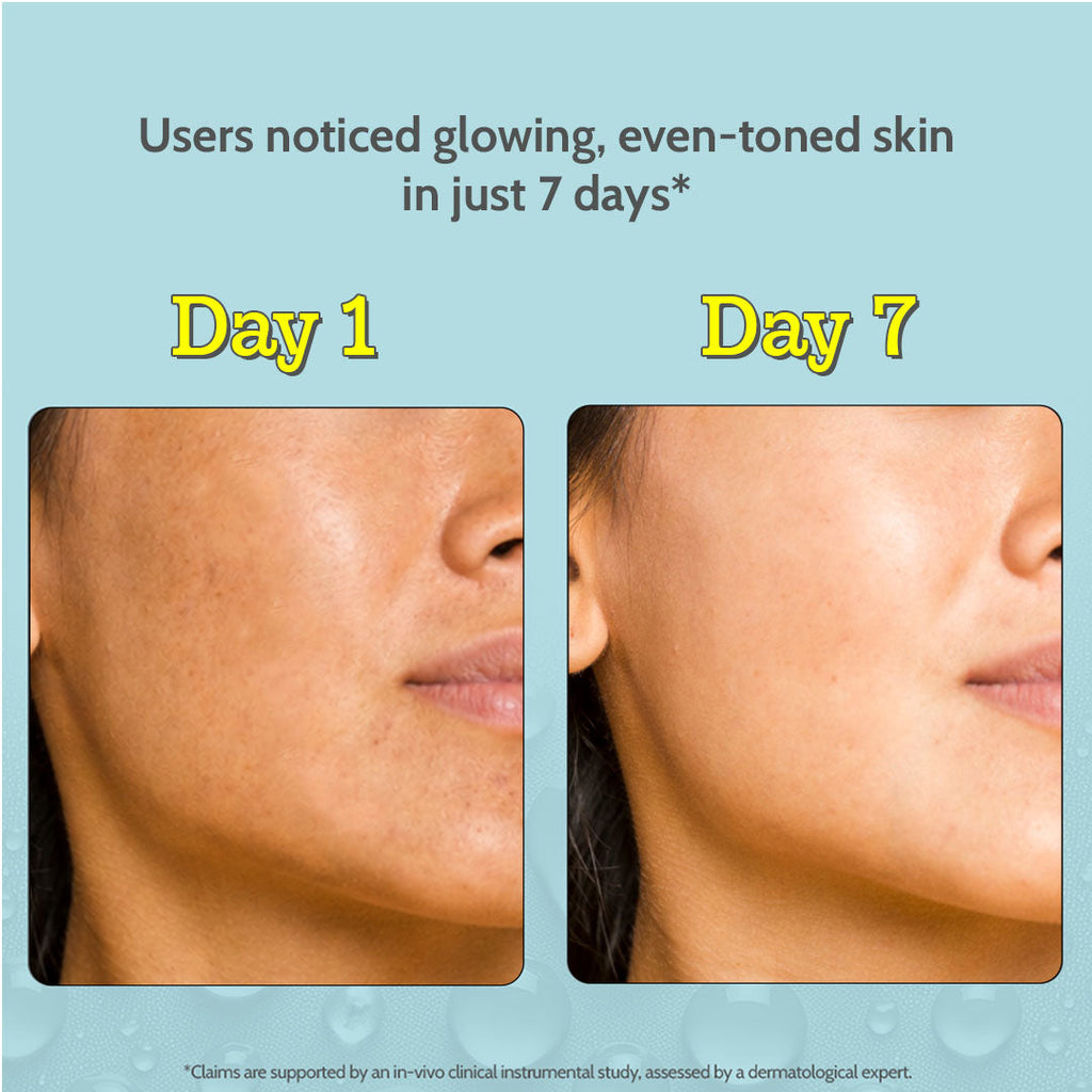 10% Vitamin C Serum for Glowing & Bright Skin - 30 ml | Pack of 2