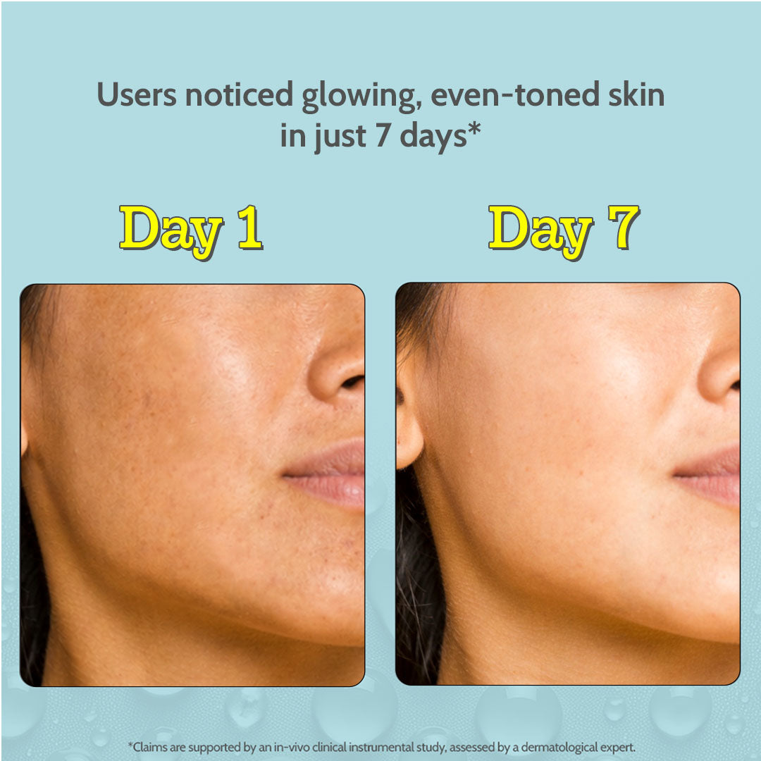 10% Vitamin C Serum for Glowing & Bright Skin - 30 ml | Pack of 2